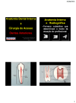 Anatomia Dental Interna e Cirurgia de Acesso Dentes Anteriores