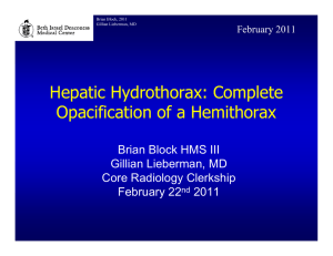 Hepatic Hydrothorax: Complete Opacification of a Hemithorax