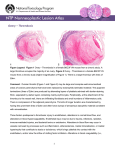 Ovary – Thrombosis