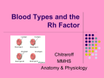 Blood Types and the Rh Factor Chitraroff MMHS