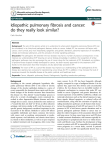 Idiopathic pulmonary fibrosis and cancer: do they really look similar? Open Access