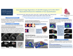 Automated Image Registration of LGE‐MR Imaging and Tc‐99m SPECT  Myocardial Perfusion for Validation of Scar Quantification