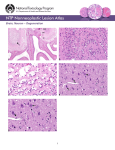 – Degeneration Brain, Neuron 1