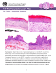 Eye, Cornea – Hyperplasia, Squamous