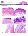 Eye – Inflammation 1