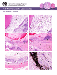 Eye, Vitreous – Fibrosis 1