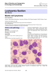 Leukaemia Section Mantle cell lymphoma Atlas of Genetics and Cytogenetics