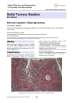 Solid Tumour Section Nervous system: Ependymomas Atlas of Genetics and Cytogenetics
