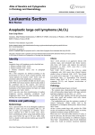 Leukaemia Section Anaplastic large cell lymphoma (ALCL) Atlas of Genetics and Cytogenetics