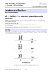Leukaemia Section t(3;21)(q26;q22) in treatment related leukemia Atlas of Genetics and Cytogenetics