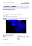 Leukaemia Section Amplified NUP214/ABL1 Atlas of Genetics and Cytogenetics in Oncology and Haematology