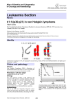 Leukaemia Section t(1;1)(p36;q21) in non Hodgkin lymphoma Atlas of Genetics and Cytogenetics