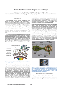 Visual Prostheses: Current Progress and Challenges