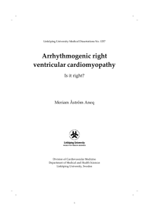 Arrhythmogenic right ventricular cardiomyopathy Is it right?