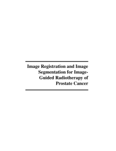 Image Registration and Image Segmentation for Image- Guided Radiotherapy of Prostate Cancer