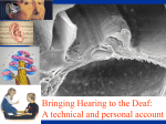 Bringing Hearing to the Deaf: A technical and personal account 1
