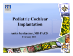 Pediatric Cochlear Implantation Anita Jeyakumar, MD FACS February 2013