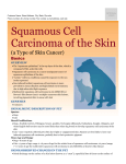squamous_cell_carcinoma_of_the_skin