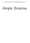 Atopic Eczema