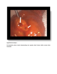 Supplementary Image 1: Intra-operative picture clearly