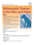melanocytic_tumors_of_the_skin_and_digits