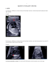 Quality control of routine second trimester four chamber view