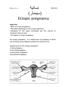 Previous ectopic pregnancy.