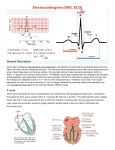 Electrocardiogram (EKG, ECG) - Dr. Ray Winstead`s Front Page