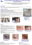 (XRB 50) for carcinoma of the eyelid