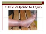 Tissue Response to Injury