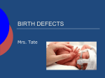 Birth Defects Birth Defects