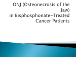 ONJ (Osteonecrosis of the Jaw) in Bisphosphonate