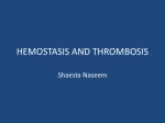 Venous thrombosis