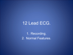 12 Lead ECG.