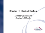Chapter 11: Skeletal Healing