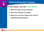 Heart Disease powerpoint