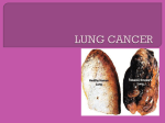 LUNG CANCER