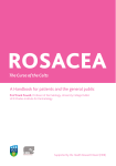 Rosacea: The Curse of the Celts