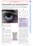 Conjunctivitis and chloramphenicol