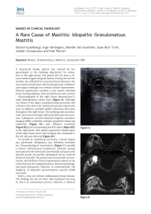 A Rare Cause of Mastitis: Idiopathic Granulomatous Mastitis