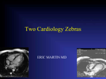 Two Cardiology Zebras - Iowa Heart Foundation