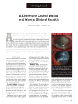 A Distressing Case of Waxing and Waning Bilateral Keratitis