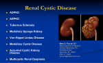 Autosomal recessive PKD