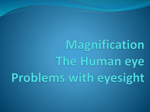 correcting human eye defects ppt File