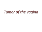 Tumour of the vagina