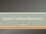 Epidural/Subdural Hematoma*s - 1B