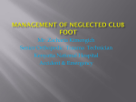 management of neglected club foot