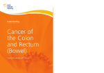 Understanding cancer of the colon and rectum