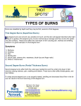 Types of Burns - Burn Prevention Network