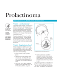 Prolactinoma - Barts Endocrinology